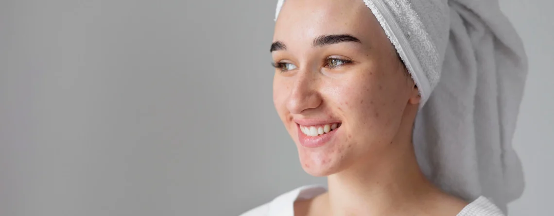 Hydrafacial for Problematic Skin
