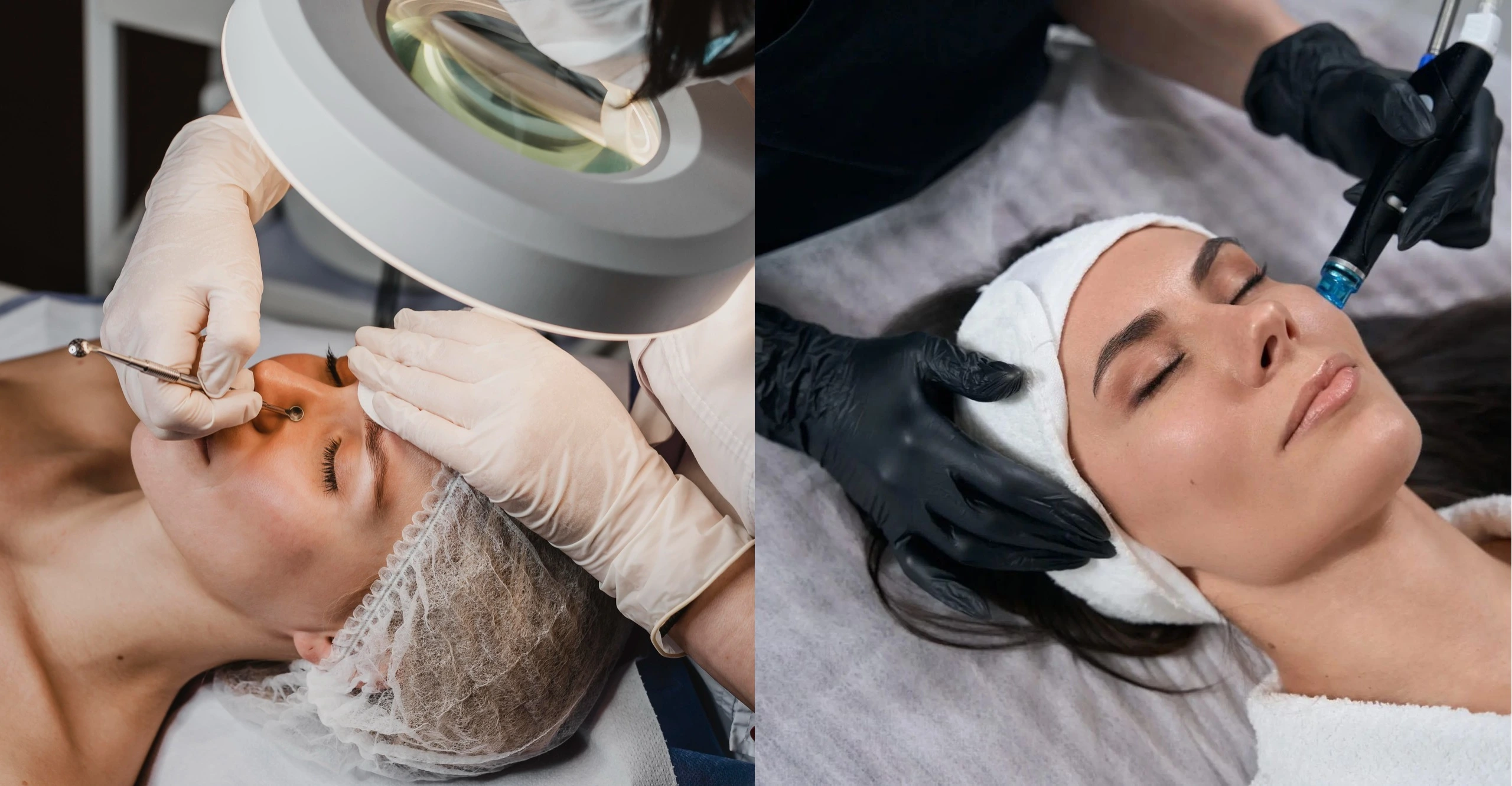 „Hydrafacial“ ar valymas